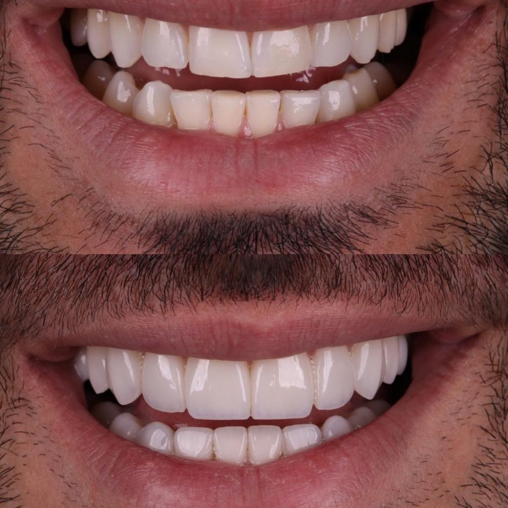 WhatsApp Image 2025-11-17 at 18.33.29