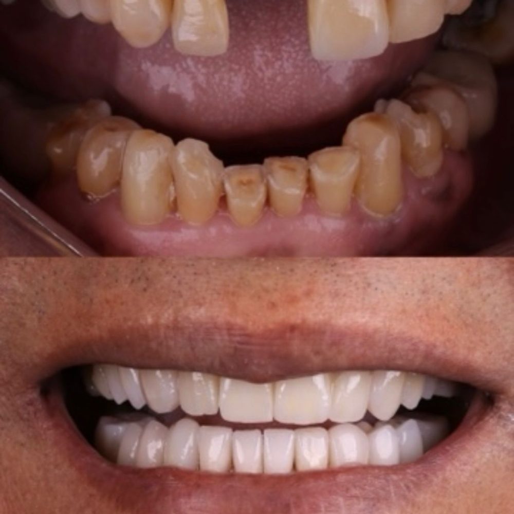 WhatsApp Image 2025-11-19 at 13.15.55